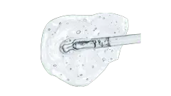 Acido Hilauronico